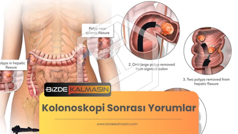 Kolonoskopi Sonrası Yorumlar