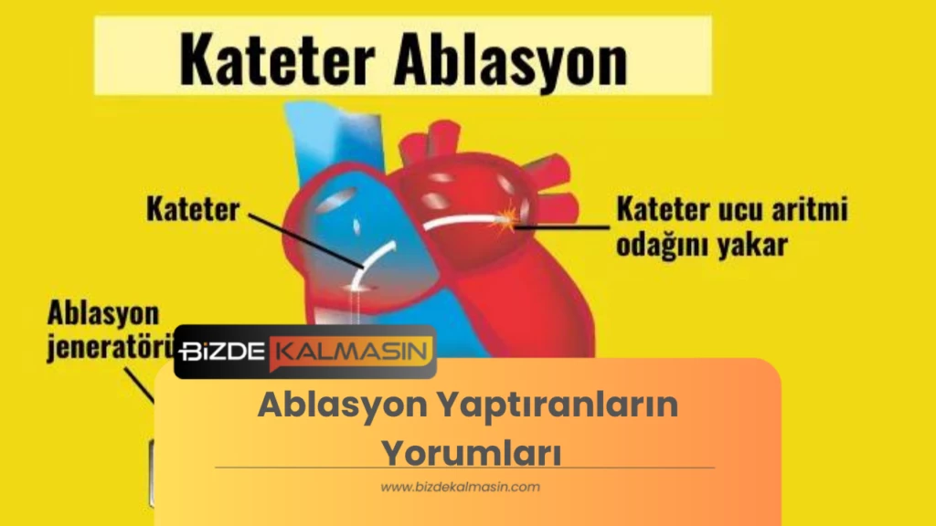 Ablasyon Yaptıranların Yorumları